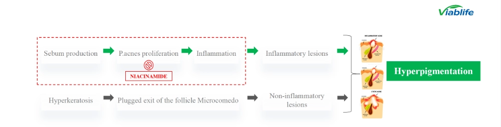 मुँहासे प्रबंधन में निकोटिनामाइड Nicotinamide in Acne Management
