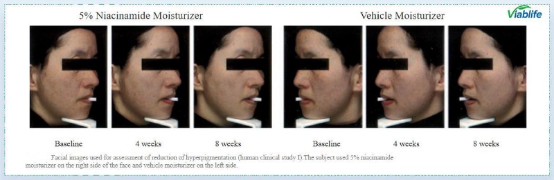 त्वचा की चमक के लिए निकोटिनामाइड Nicotinamide for Skin Brightening